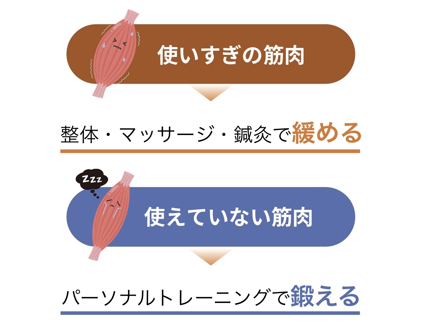 アッパー・クロス・シンドローム